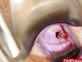 Mature woman gets her hairy pussy examined by the doctor